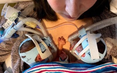26 week old twin girls lay on their momma connected to medical devices.