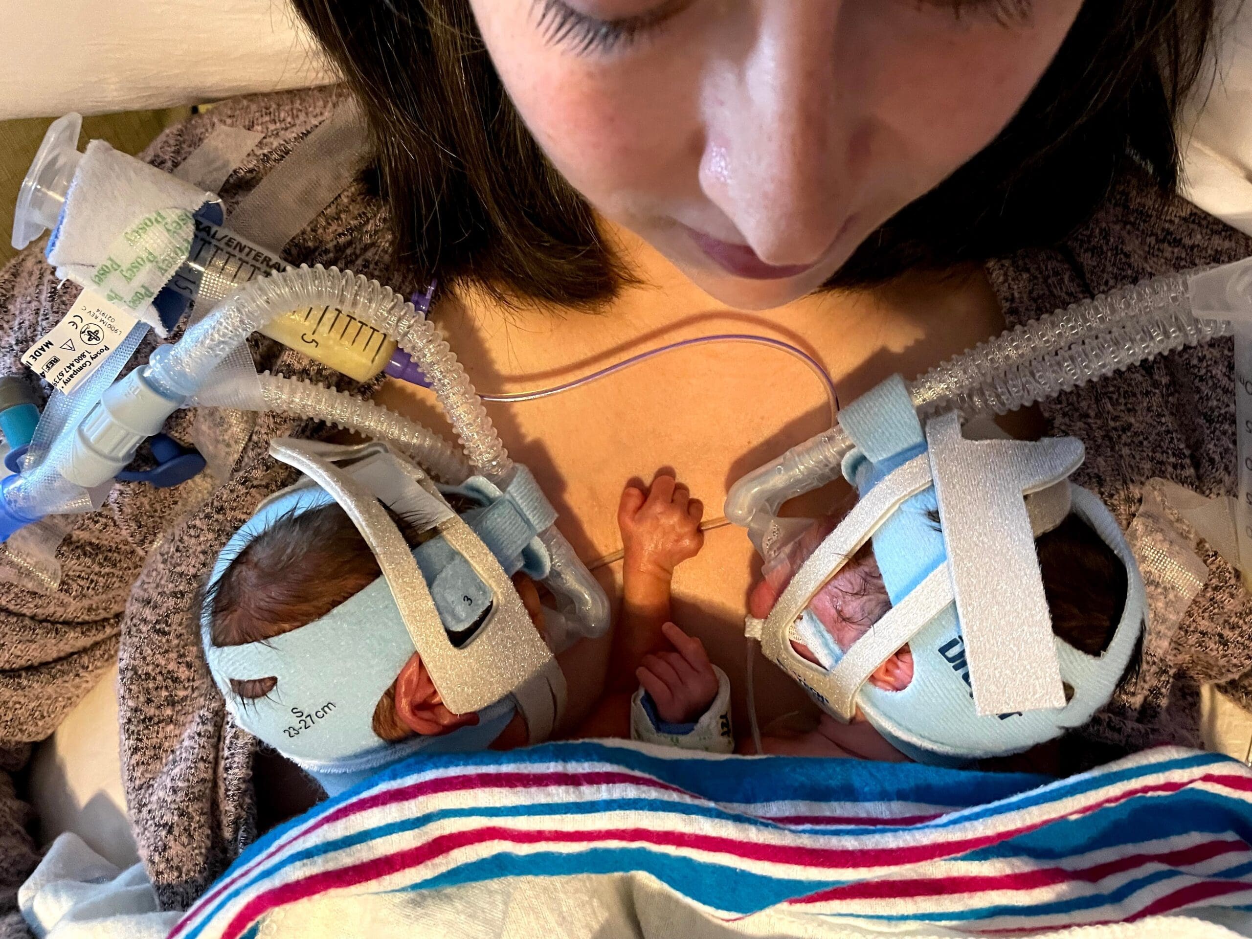 26 week old twin girls lay on their momma connected to medical devices.